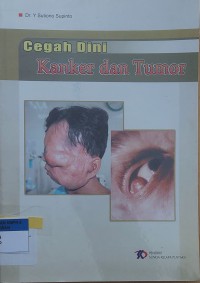 Cegah Dini Kanker dan Tumor